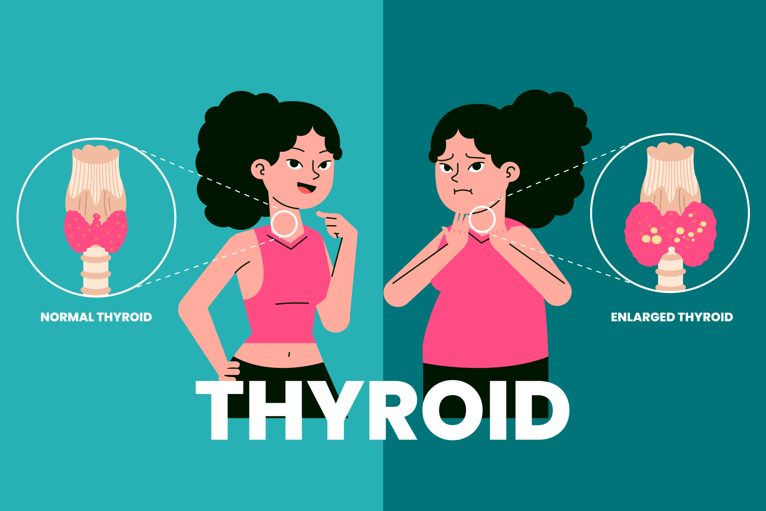 hyperactive thyroid