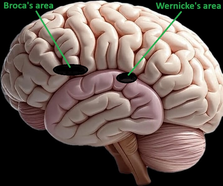 Wernick's area